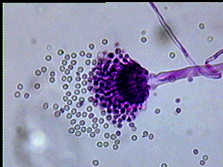 aspergillus mold